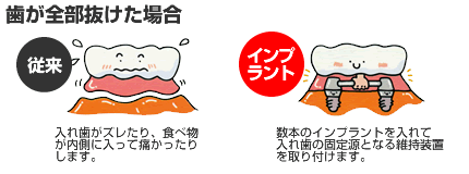 �����S���������ꍇ�̃C���v�����g����